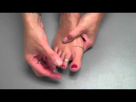 Видео: Hallux Rigidus/Hallux Limitus: самостоятельная мобилизация суставов