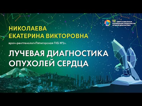 Видео: Лучевая диагностика опухолей сердца - Николаева Екатерина Викторовна