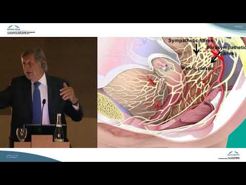 Видео: Нервосберегающая цистэктомия у пациентов  с ортотопическим отведением мочи