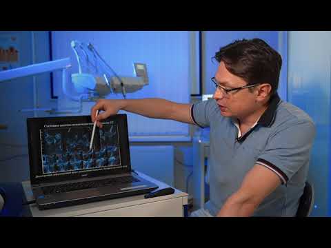 Видео: Тотальное протезирование пациента с двусторонним артрозом ВНЧС (в 4-х частях)