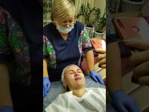 Видео: Пилинг Джеснера Биоматрикс