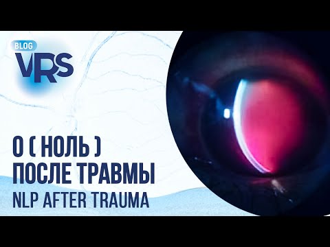 Видео: Тяжелая травма глаза. Возможно ли вернуть зрение? | Severe eye injury.