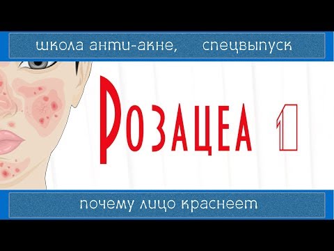 Видео: РОЗАЦЕА 1 | Rosacea | Лечится ли, причины и ошибки