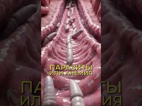 Видео: ПАРАДОКС ФЕРРИТИНА #здоровье #паразиты #анализкрови
