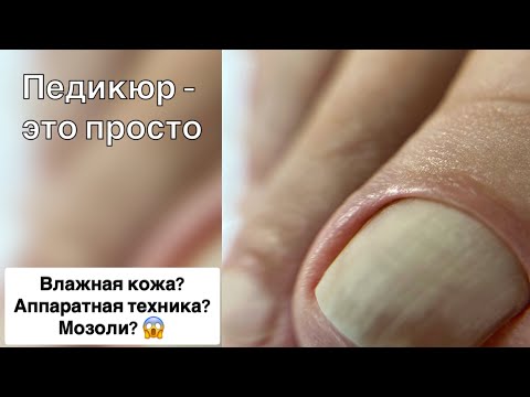Видео: Аппаратный педикюр