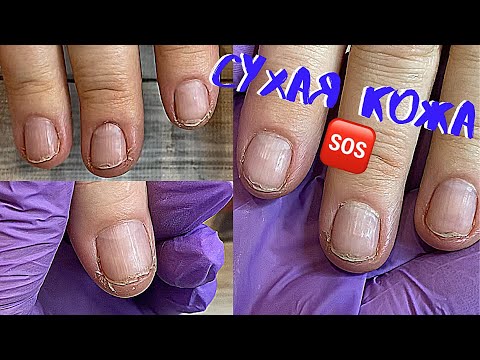 Видео: 😱ЖУТКО СУХАЯ КОЖА❗️Как с такой работать⁉️|ТРЕЩИНЫ НА ПАЛЬЦАХ РУК| Возрастные руки