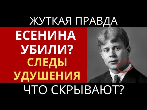 Видео: Тайна Смерти Есенина: Поэт Повесился или Его Убили? Следы Удушения на Шее
