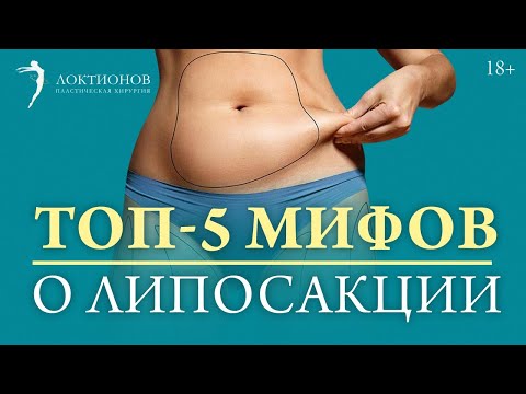 Видео: Липосакция: самые распространенные мифы // 18+