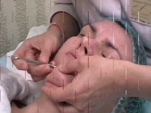 Видео: Чистка лица