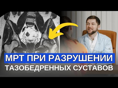 Видео: КАК ЧИТАТЬ МРТ ТАЗОБЕДРЕННОГО СУСТАВА. Разбор реального пациента