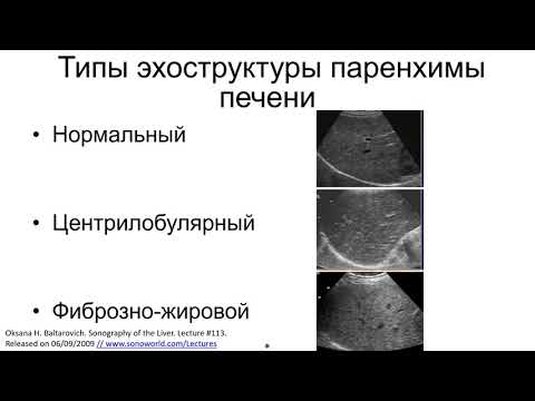 Видео: Классификация диффузных изменений печени