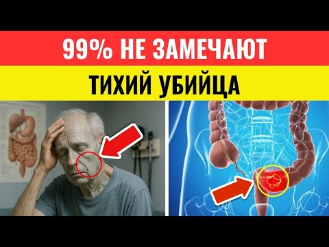 Видео: ВНИМАНИЕ! 5 признаков рака кишечника, которые большинство игнорируют — а зря. Это может стоить жизни