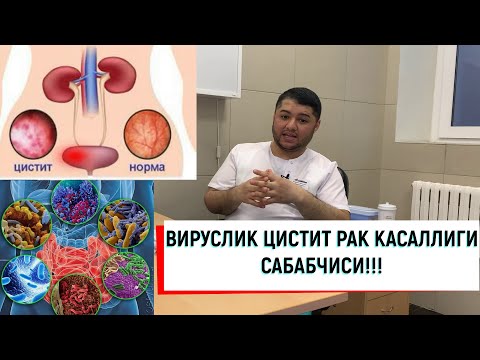 Видео: ЦИСТИТ КАСАЛЛИГИ ВИРУСДАН БУЛГАН САБАБЛАРИ ВА РАК КАСАЛЛИГИ