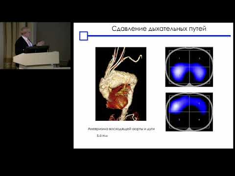 Видео: ЭИТ легких для анестезиолога АКСЕЛЬРОД Б.А.
