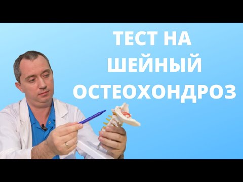 Видео: Как определить шейный  остеохондроз?