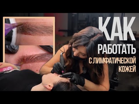 Видео: Как работать с лимфатической кожей?