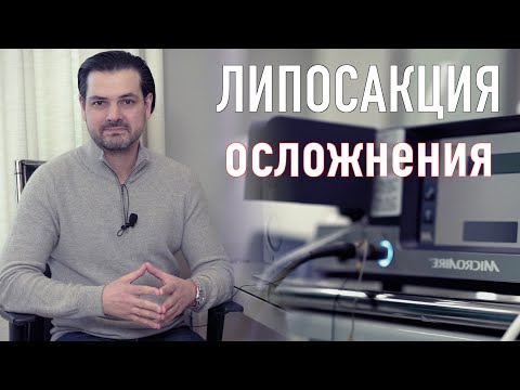 Видео: Липосакция // Осложнения // Неровности на коже