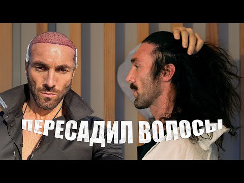 Видео: Пересадка волос