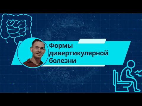 Видео: Формы дивертикулярной болезни