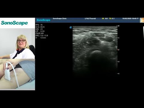 Видео: Мастер-класс на аппарате SonoScape S8Exp. Лектор: Заболотская Н.В.
