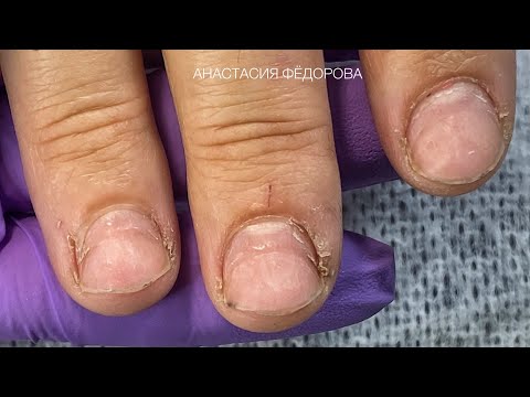 Видео: Сложная кутикула, 3 главных  правила в наращивание на гелевые типсы🤗