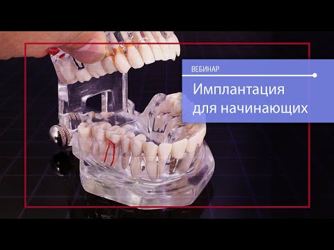 Видео: Имплантация для начинающих