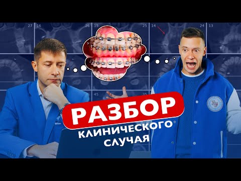 Видео: Разбор клинического случая. Долечивание пациентов.