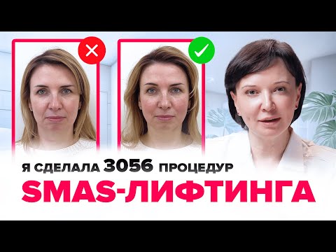 Видео: Почему SMAS-ЛИФТИНГ лица на аппарате Ультраформер - лучшая процедура для омоложения | Ирина Рахова