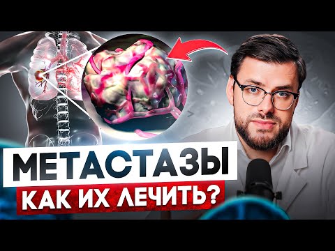 Видео: Что такое МЕТАСТАЗЫ и как их ПОБЕДИТЬ? Секреты лечения