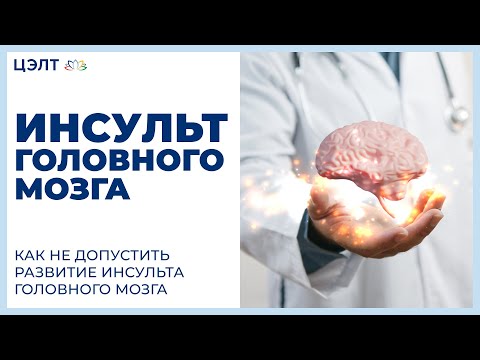 Видео: Инсульт головного мозга. 😨 Как не допустить развитие инсульта головного мозга. ЦЭЛТ