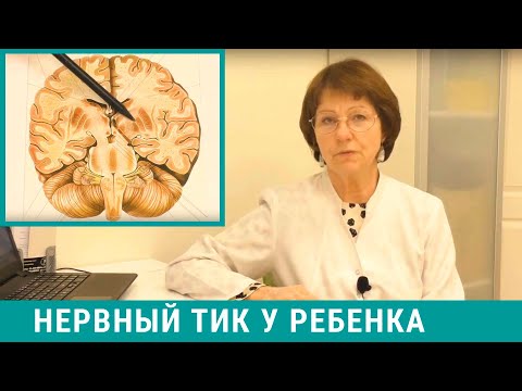 Видео: Нервный тик у ребенка - как мы лечим