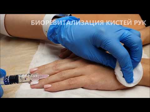 Видео: Биоревитализация кистей рук в клинике Д-мед.