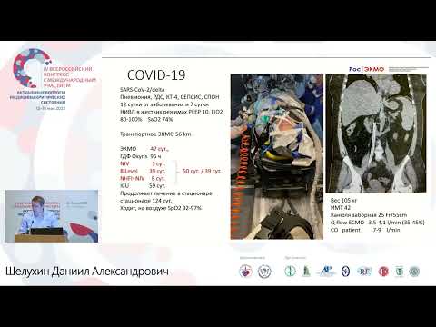 Видео: Кислородный баланс цель ЭКМО Шелухин Д.А.
