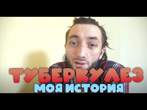 Видео: Как я заболел туберкулезом и излечился!