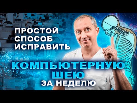 Видео: Эпидемия компьютерной шеи. Какие делать упражнения для шеи?