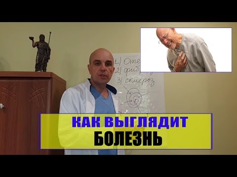 Видео: 12. Уроки остеопатии 12 # Как выглядит Ваша болезнь или что такое дисфункция в теле