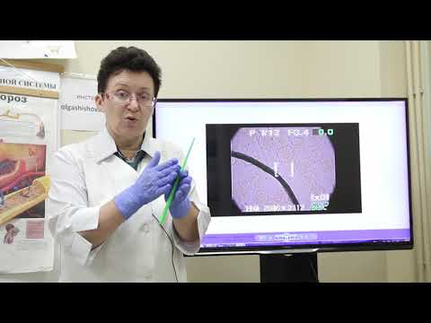 Видео: Профилактика остеопороза.