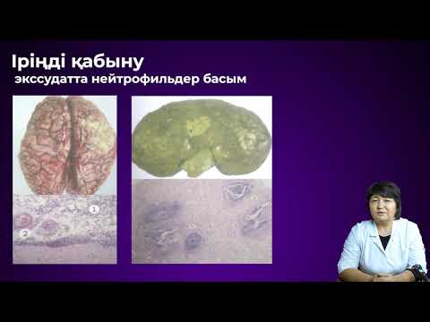 Видео: Қабыну