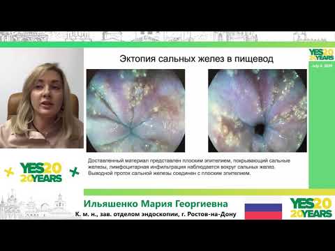 Видео: 42. EndoBook: эндоскопический атлас редких клинических наблюдений.  М. Г. Ильяшенко, З. В. Галкова