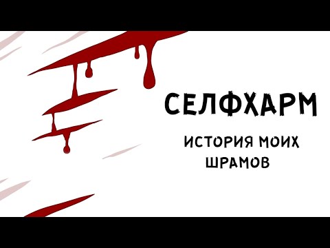 Видео: ИСТОРИЯ МОИХ ШРАМОВ