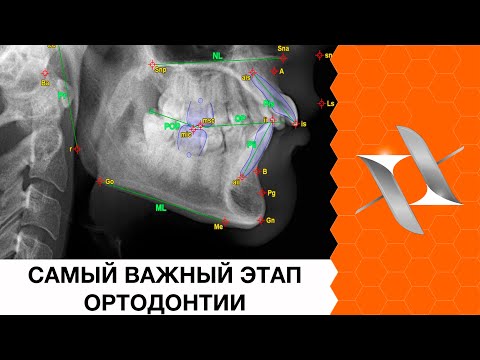 Видео: Диагностика и планирование ортодонтического лечения