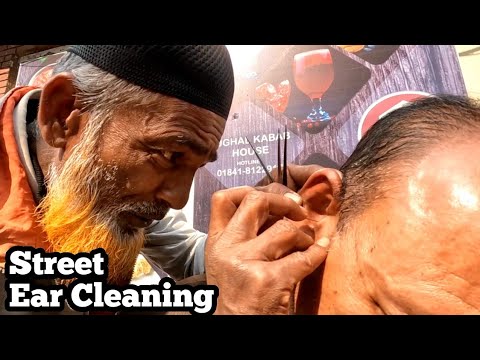 Видео: Суперинтенсив _ Street Чистка ушей