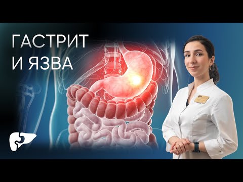 Видео: Гастрит и язва желудка
