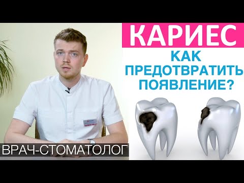 Видео: Как предотвратить появление кариеса. Что такое кариес, причины, последствия если не лечить кариес