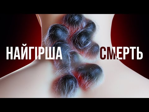 Видео: Це станеться, якщо вас вкусить найотруйніша істота!