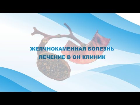 Видео: Желчнокаменная болезнь лечение в ОН КЛИНИК