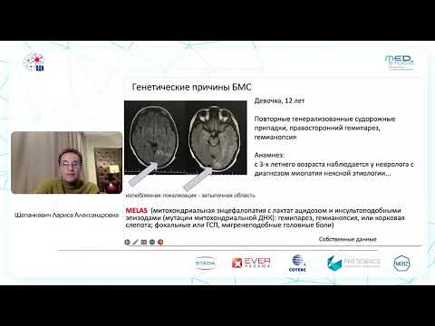 Видео: Болезнь малых сосудов как процесс с общей клинической симптоматикой. д.м.н., проф. Щепанкевич Л.А.