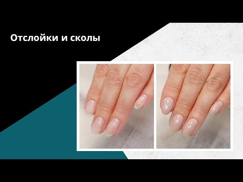 Видео: Отслойки и сколы на ногтях. СЕКРЕТЫ прочного покрытия.