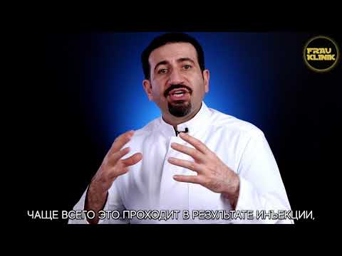 Видео: ОСЛОЖНЕНИЯ ПОСЛЕ РИНОПЛАСТИКИ