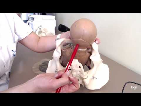 Видео: Биомеханизм родов при переднеголовном предлежании